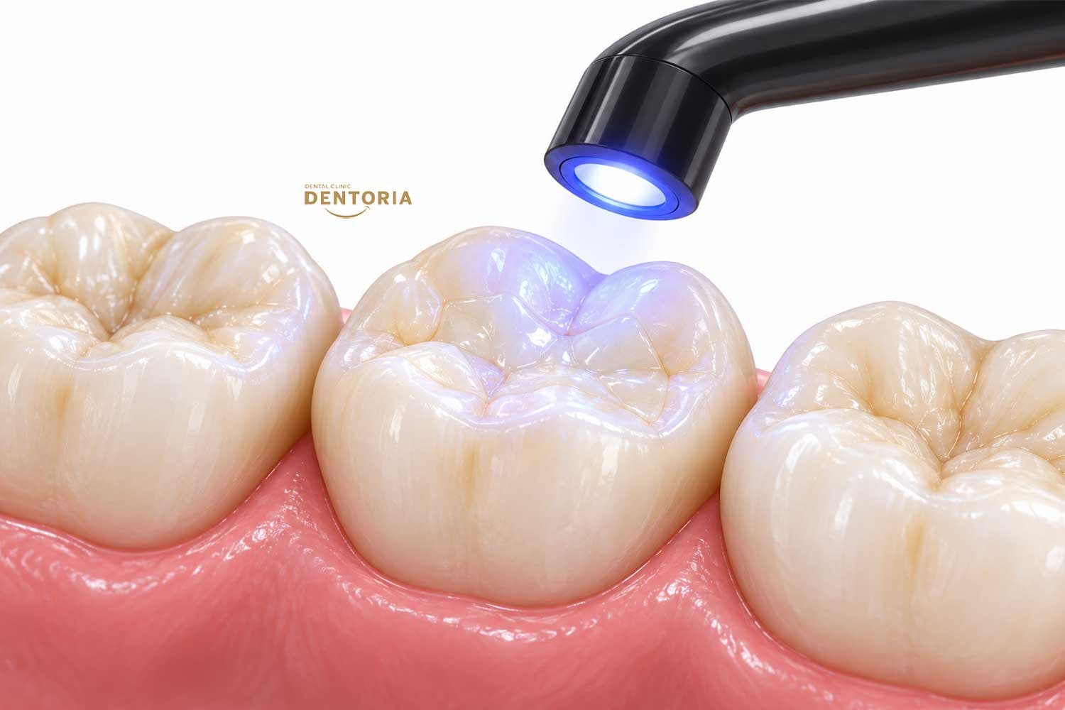 GC Essentia®
