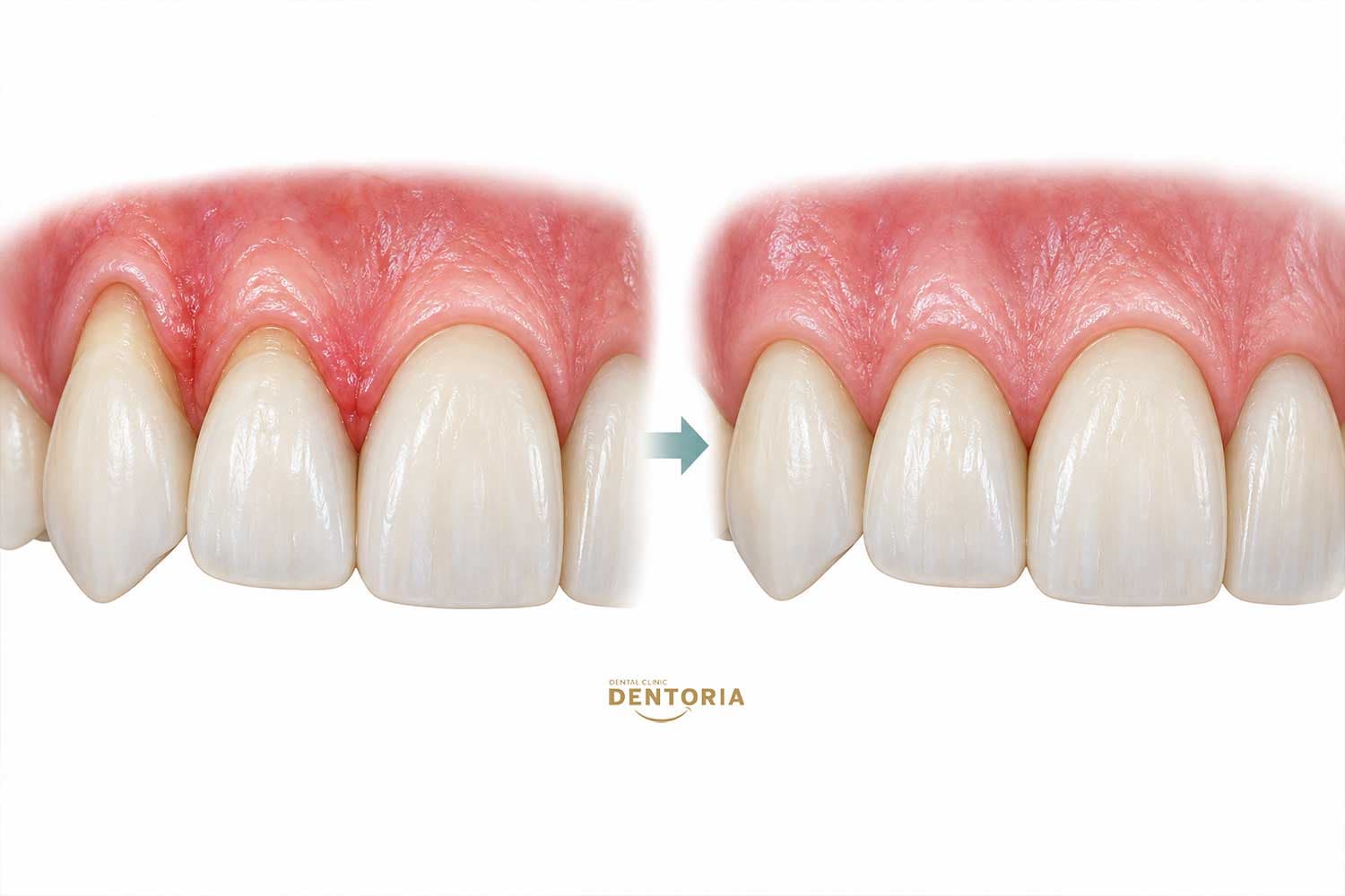 Themel periodontale